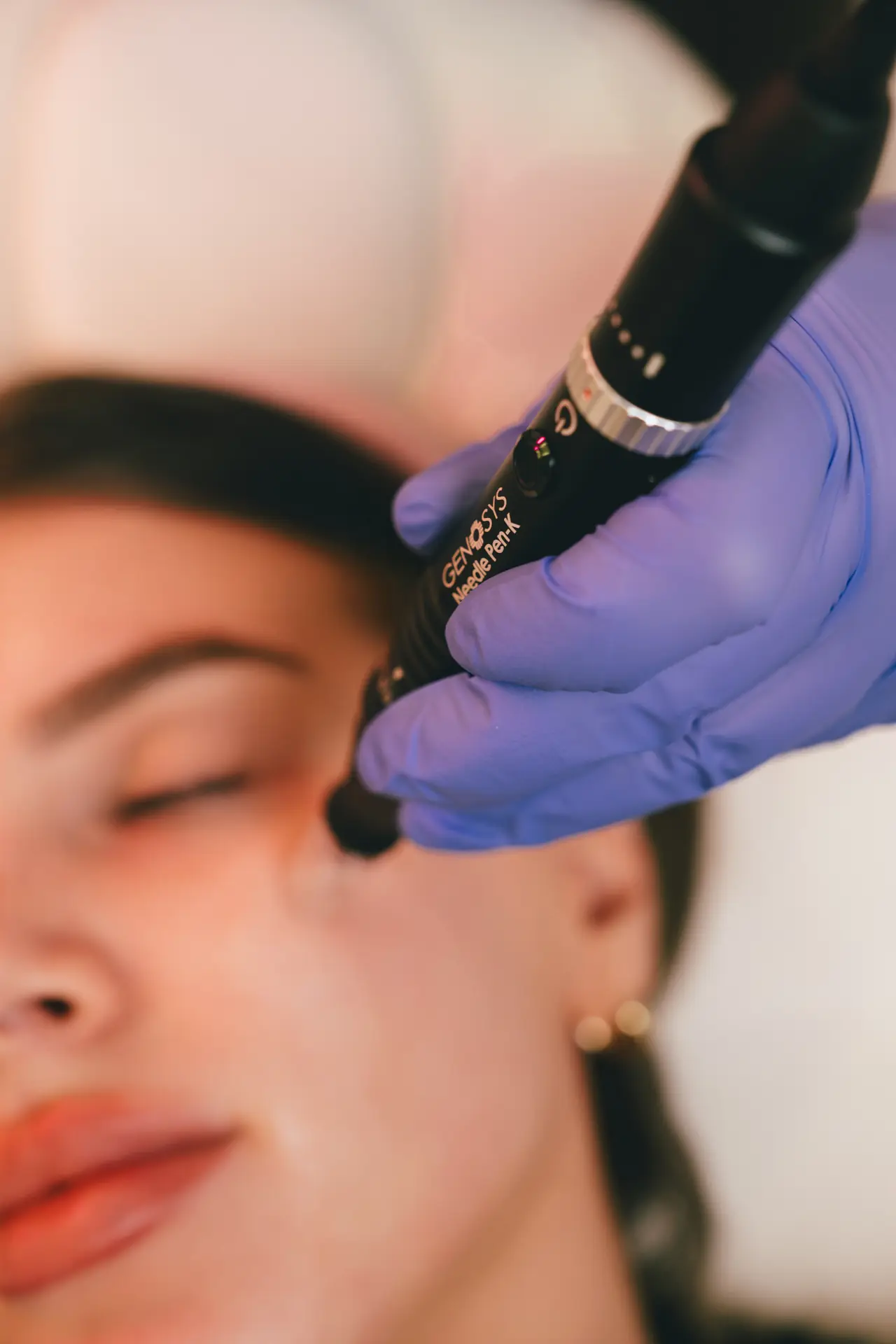 Aviva rad - tretman 4